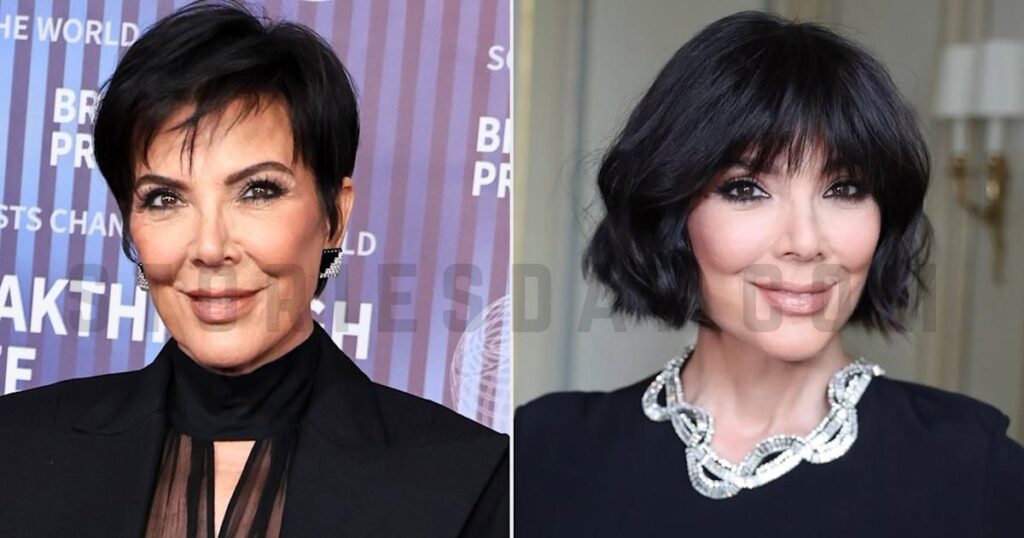 What Can People Learn From Kris Jenner’s Cosmetic Journey?